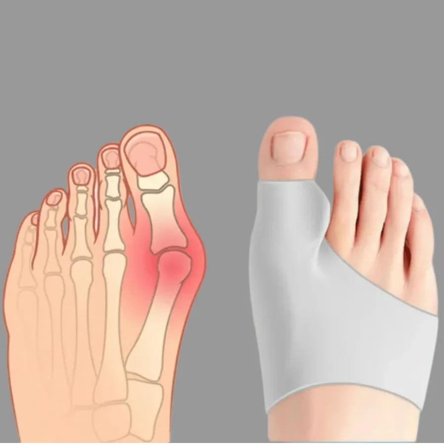 Bunion Corrector Breathable Discreet 2-Pair Set