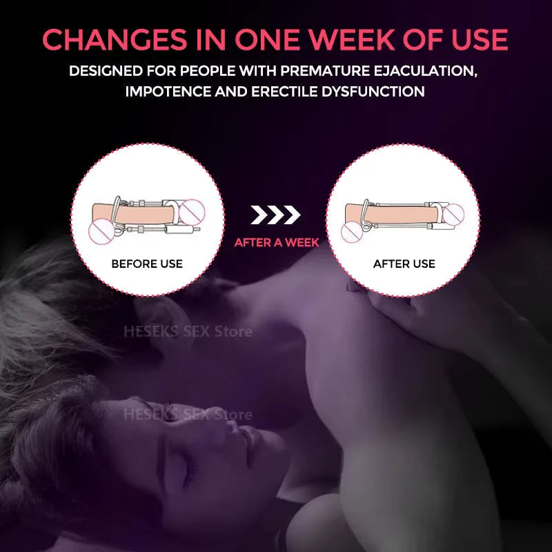 Male Traction Device Adjustable Tension Comfort Fit